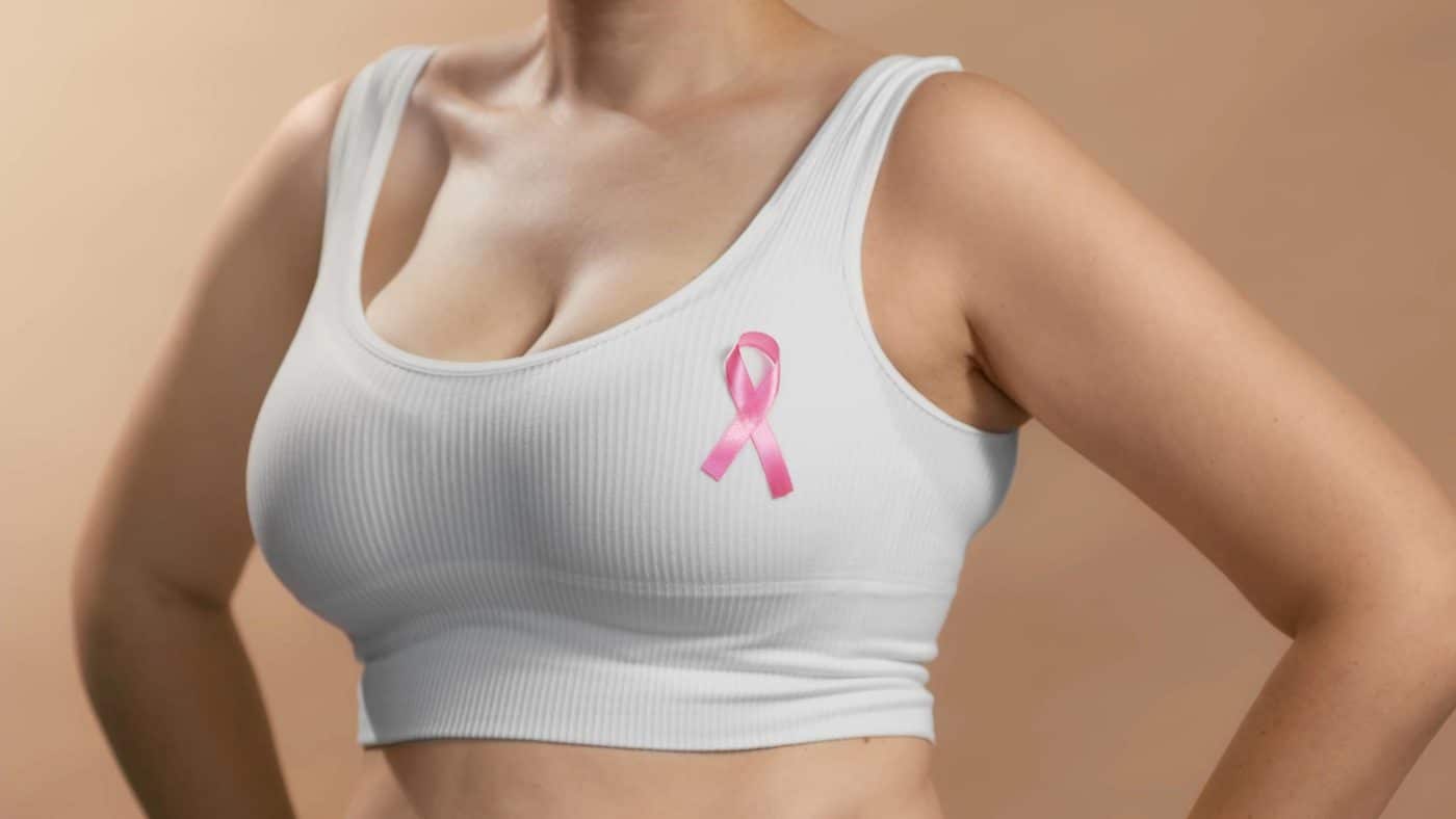 breast carcinoma מה זה