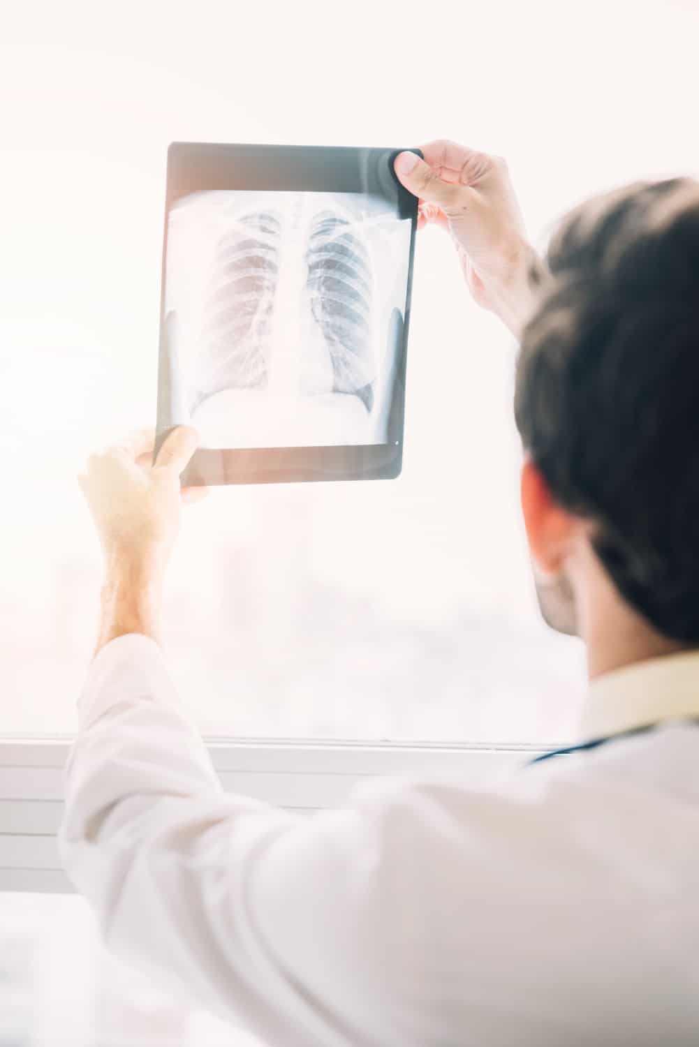 Small Cell Carcinoma מה זה