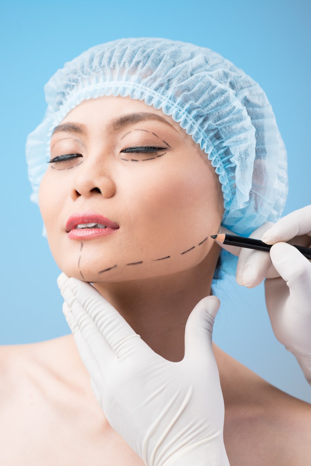 הידוק קו הלסת