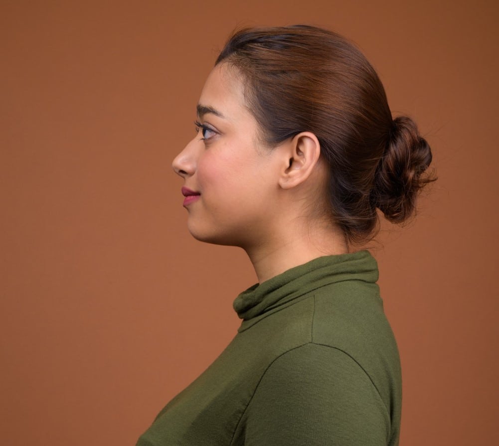 המסת שומן בסנטר כפול