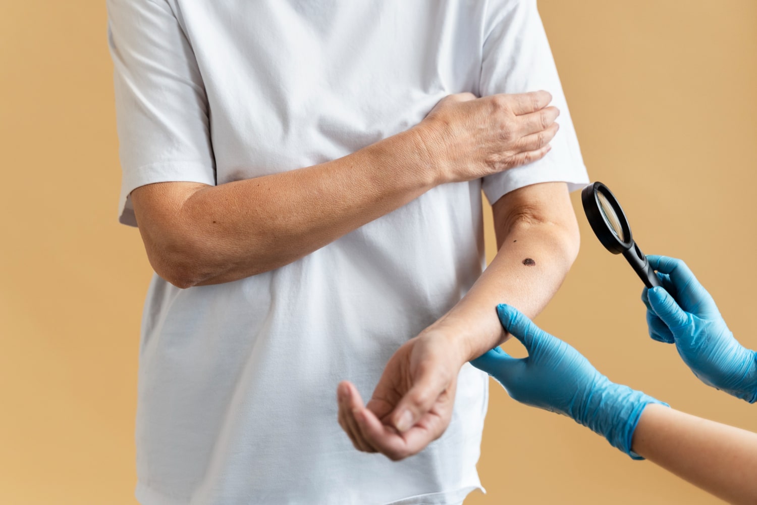 מהי קרצינומה