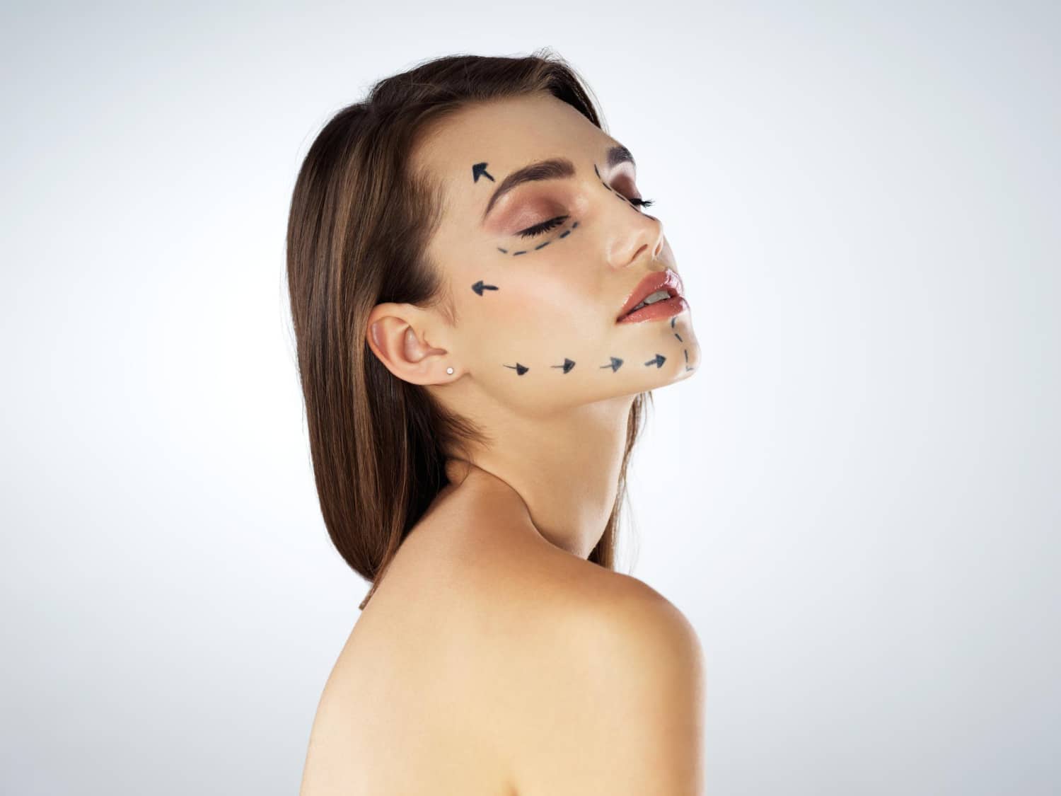 מיני ליפט ללא הרדמה