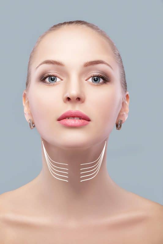 ניתוח מתיחת צוואר