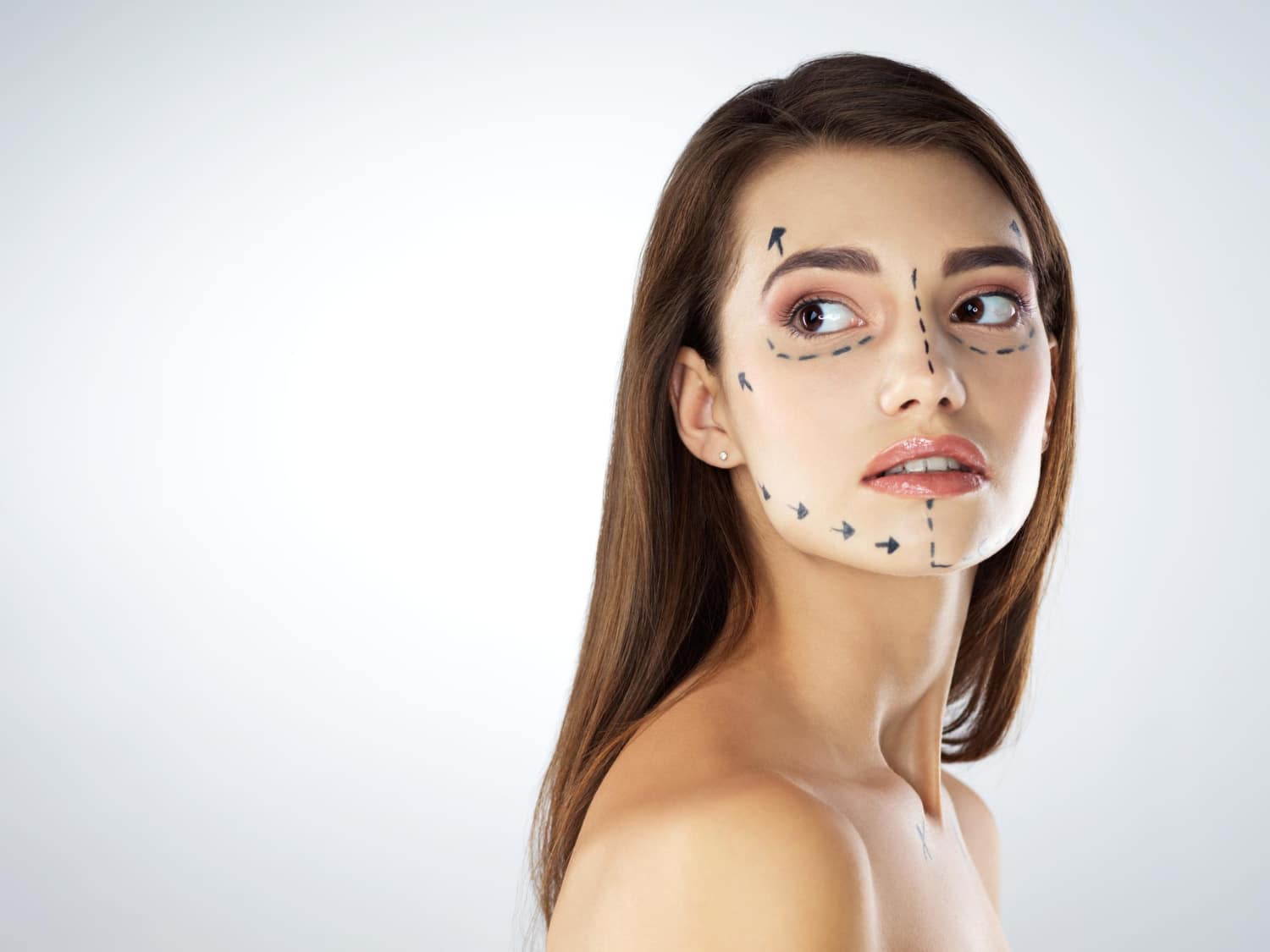 ניתוח פייס ליפט