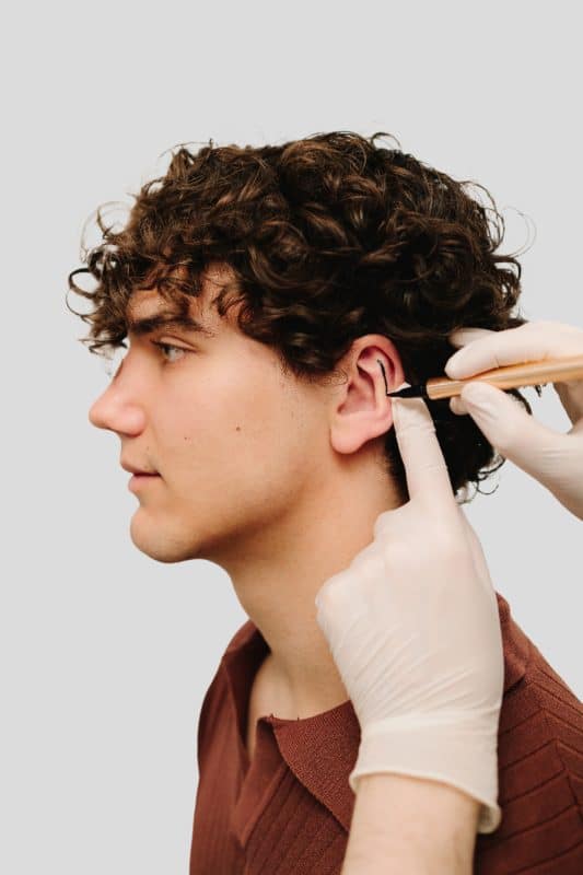 ניתוח פלסטי באוזניים