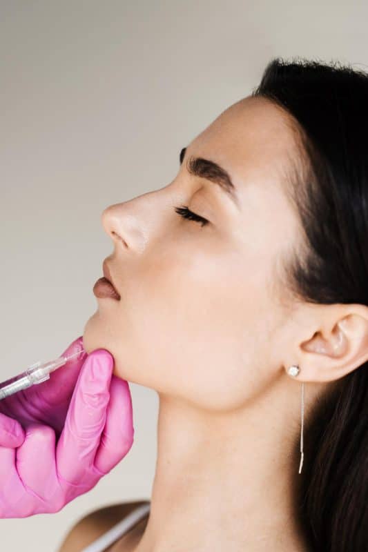 המסת שומן בסנטר