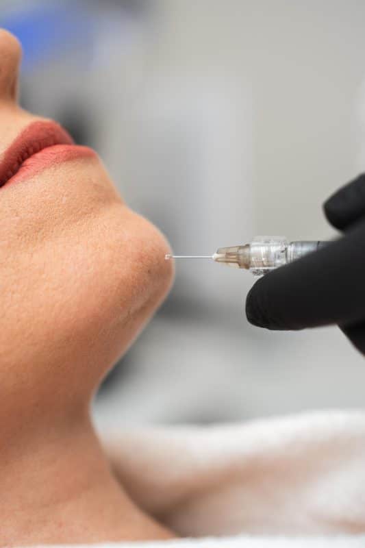 זריקה להעלמת סנטר כפול