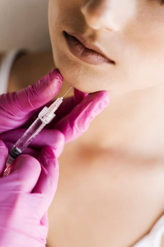 טיפול בסנטר כפול ללא ניתוח