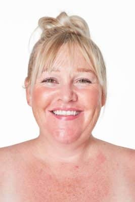 מיצוק סנטר כפול