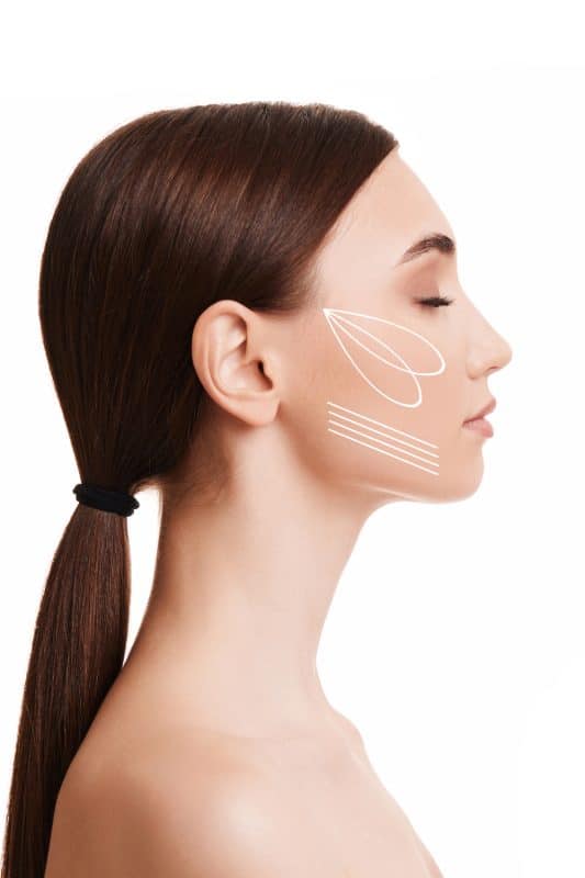 ניתוח סנטר בולט