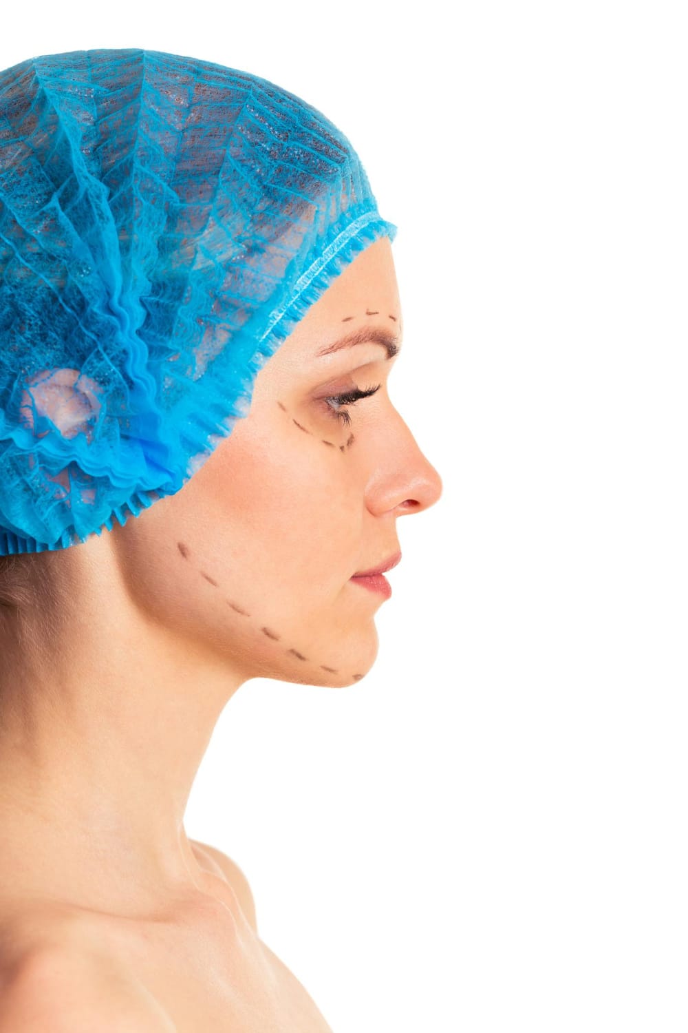 ניתוחים פלסטיים