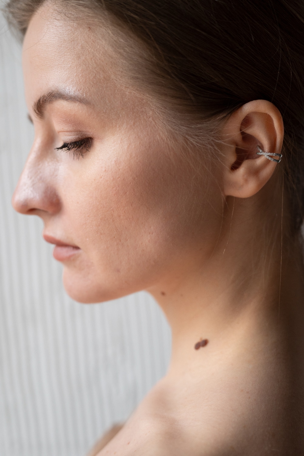 סרטן עור קשקשי