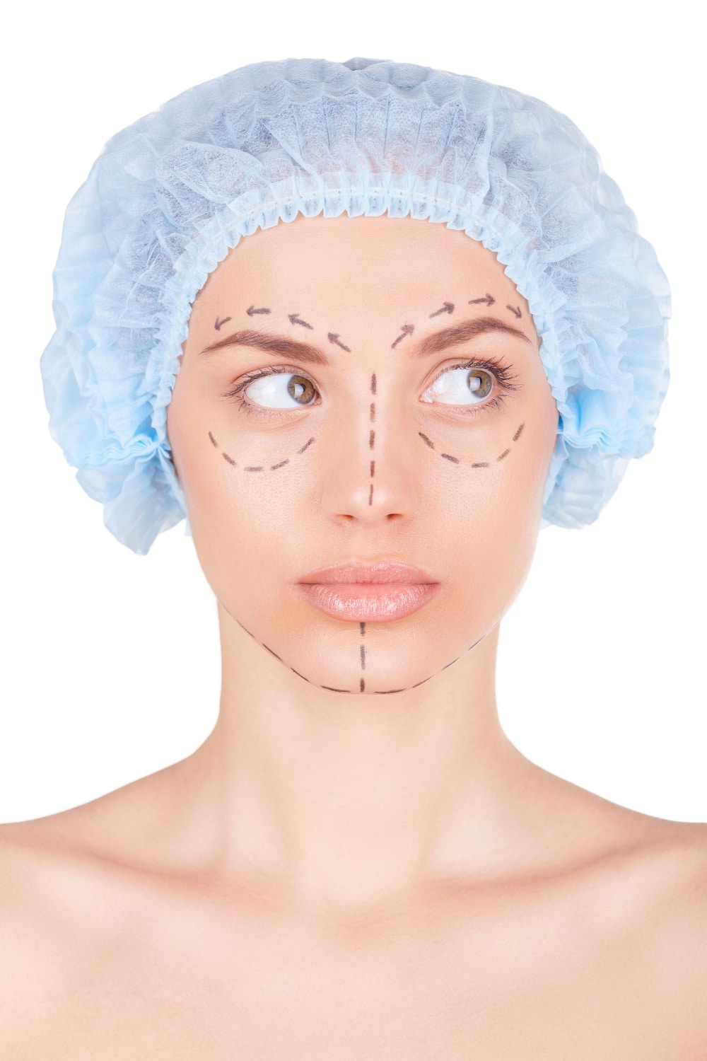 פיסול פנים חומצה היאלורונית