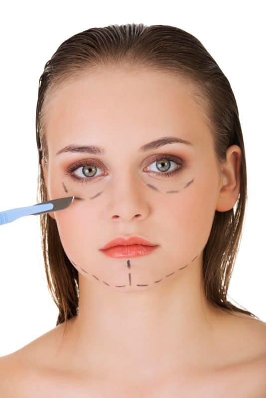 שאיבת שומן בפנים