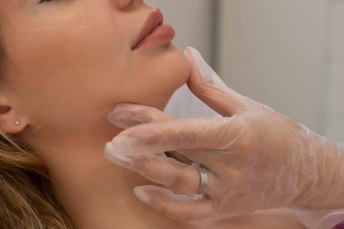 המסת סנטר כפול