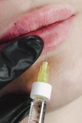 המסת סנטר כפול