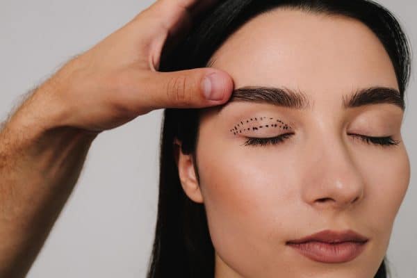 עפעפיים עליונות