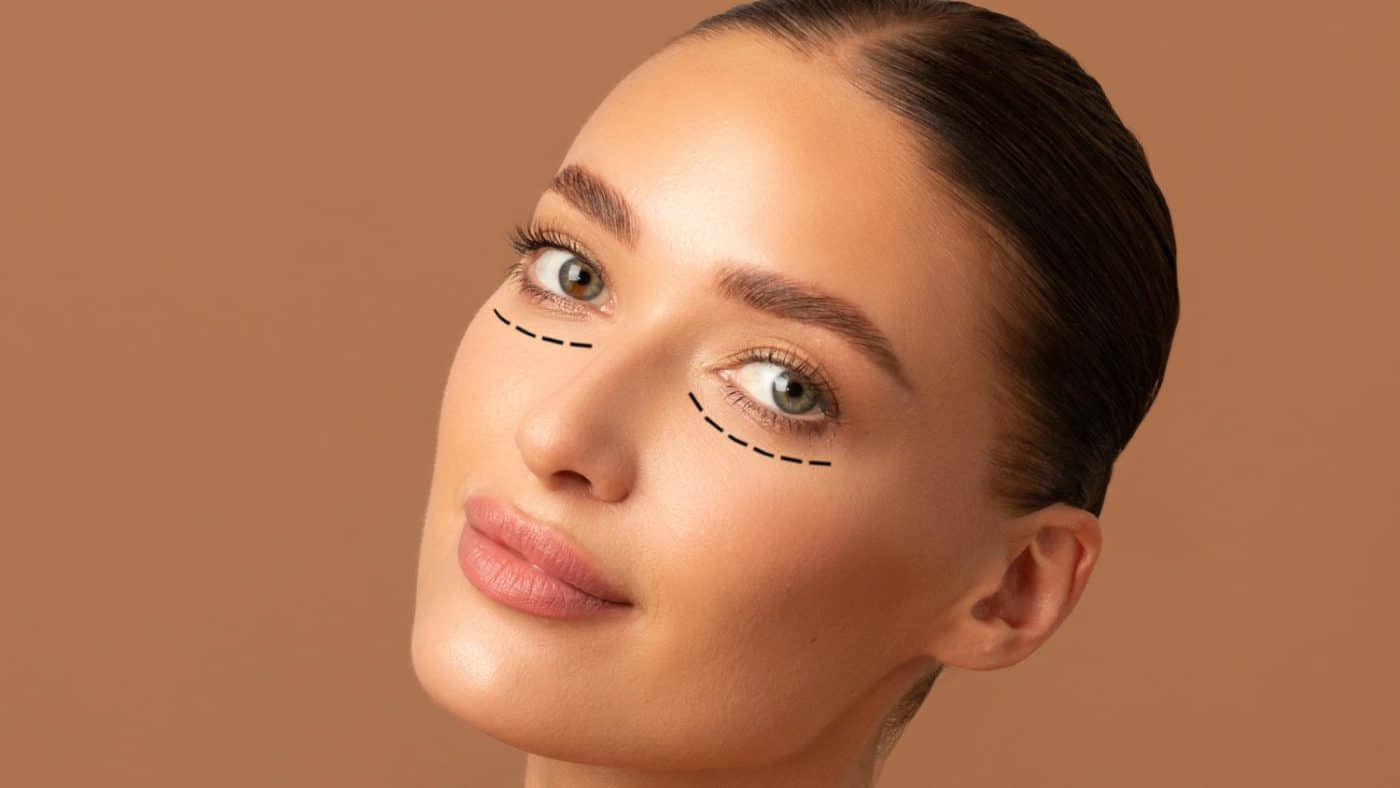 עפעפיים עליונות