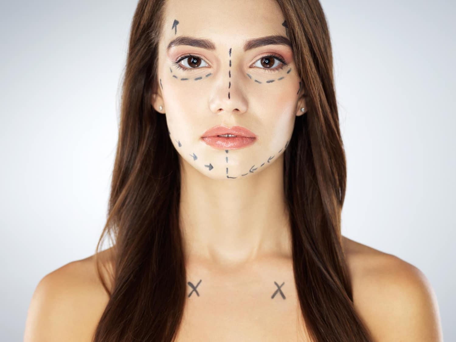 מתיחת פנים חוטים