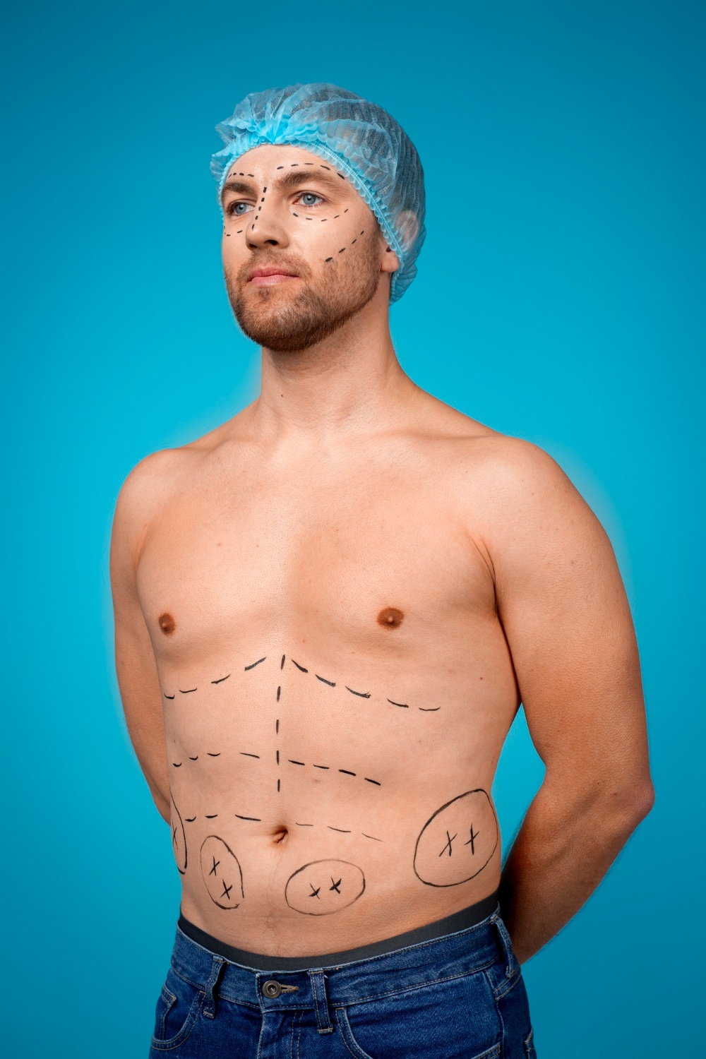 ניתוח שאיבת שומן לגברים